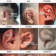 宝宝耳朵轮廓不适特别圆滑是怎么回事,胎儿耳廓图片