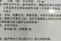 胎儿单脐动脉有什么危害（胎儿单脐动脉有什么危害吗）