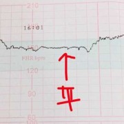胎儿多少周后容易缺氧（胎儿多少周后容易缺氧呢）