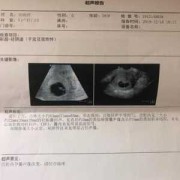 胎儿心脏不好的征兆（怀孕有9周了，产检结果见微弱原始心管搏动，这是什么意思）