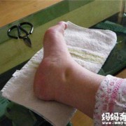 怀孕为什么脚会肿，怀孕脚肿怎么办,孕期脚肿腿肿如何缓解