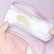 怀孕四个月白带多怎么回事,