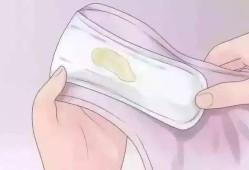 怀孕四个月白带多怎么回事,
