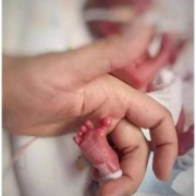 孕35周早产宝宝有事吗？宝宝成活率高吗,35周胎儿早产严重吗要住保温箱吗