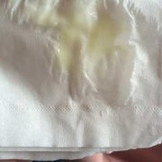 孕期霉菌是什么症状（孕妇白带检查霉菌为阳性有问题吗）