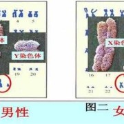 胎儿染色体y（y染色体是怎么组成）