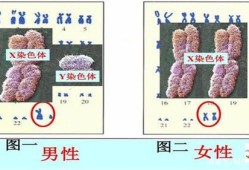 胎儿染色体y（y染色体是怎么组成）