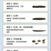 孕期拉软便（孕期拉软便正常吗）