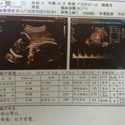 胎儿侧面图（侧面描写表现小孩的可爱）