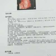 胎儿胃泡小（胎儿胃泡小是怎么回事）