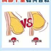 孕期怎么防止胸下垂（孕期怎么防止胸下垂呢）