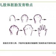 胎儿短肢畸形（胎儿短肢畸形 诊断标准）
