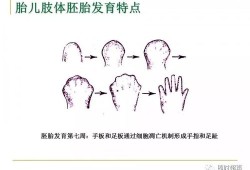 胎儿短肢畸形（胎儿短肢畸形 诊断标准）