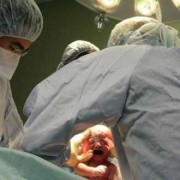 37周胎儿可以剖腹产吗（37周胎儿可以剖腹产吗视频）