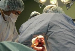 37周胎儿可以剖腹产吗（37周胎儿可以剖腹产吗视频）