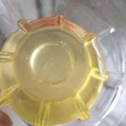 怀孕27周，小便混浊并且有油花，正常吗,怀孕期间尿液浑浊是怎么回事