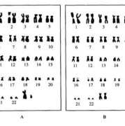 胎儿染色体检查必要吗（胎儿染色体检查什么）