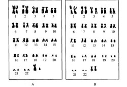 胎儿染色体检查必要吗（胎儿染色体检查什么）
