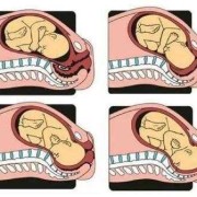 孕妇胎儿入盆的表现是什么,胎儿入盆是什么感觉和症状