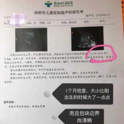 胎儿有瘤（产科医生婴儿肿瘤第几集）
