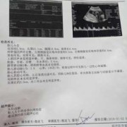 胎儿心跳加快（胎心快是什么原因）