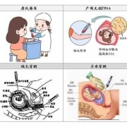 什么叫唐氏综合症,孕期综合症的表现怎么调节