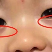 九个月宝宝眼袋看起来好重,九个月胎儿图片