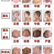 宝宝头骨发育过程,胎儿颅骨发育过程图