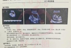 孕妇可以憋尿吗,胎儿憋尿B超会出现什么结果