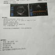 fl是什么中文缩写,fl是胎儿的什么指标