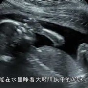 胎宝宝在肚子里会睁眼吗,胎儿会睁开眼睛吗图片