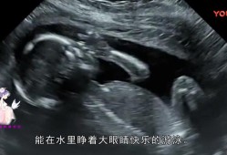 胎宝宝在肚子里会睁眼吗,胎儿会睁开眼睛吗图片