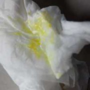 孕期溢乳是什么颜色（孕期溢乳是什么颜色的）