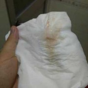 孕期流血会影响胎儿吗（怀孕13周，突然见红是怎么回事，宝宝会不会有危险，挺着急的）