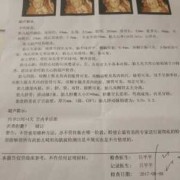 胎儿胆囊偏大有什么影响（四维彩超胎儿胆囊偏大有什么影响）