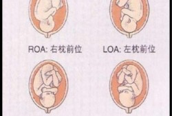 三十二周胎儿发育情况（孕32周胎位LOT是什么意思？可以给孕妇吃什么东西）