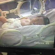 怀孕35周了，胎儿偏小怎么办,35周胎儿偏小怎么补救视频