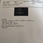 胎儿偏小三周怎么办（36周胎儿偏小三周怎么办）