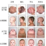 胎儿头大好吗（胎儿头大有事吗）