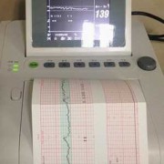 家用胎心监护仪对胎儿有影响吗（家用胎心监护仪对胎儿有影响吗 知乎）