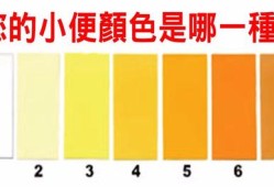 怀孕期尿黄正常吗（怀孕期尿黄正常吗）