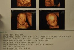 b超对胎儿有影响吗（怀孕做B超医生用力摁敲打肚子对孩子有影响吗）