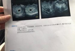 怀孕后做阴超对胎儿有影响吗,早孕阴超对胎儿影响大不大