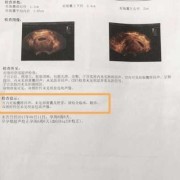 胎儿没胎心是怎么回事（怀孕两个月胎儿没胎心是怎么回事）