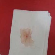 怀孕早期出少量血对胎儿发育有影响吗？要注意什么,早孕期间少量出血是怎么回事