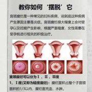 孕期宫颈糜烂怎么办（孕期宫颈糜烂怎么办呢）