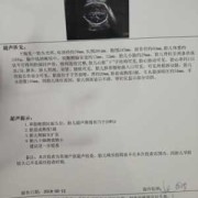 胎儿小脑发育偏小（胎儿小脑发育偏小）