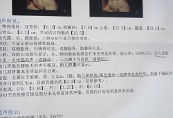 怀孕24周胎儿彩超图（怀孕24周四维彩超左心室有两个强回声点怎么办）