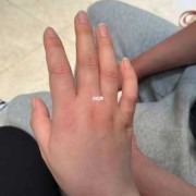 孕期手臂疼（孕期手臂疼）