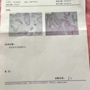 胚胎病理检查费用,胎儿筛查是什么意思